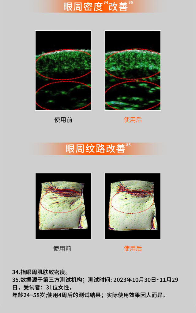 AG旗舰厅人参眼霜