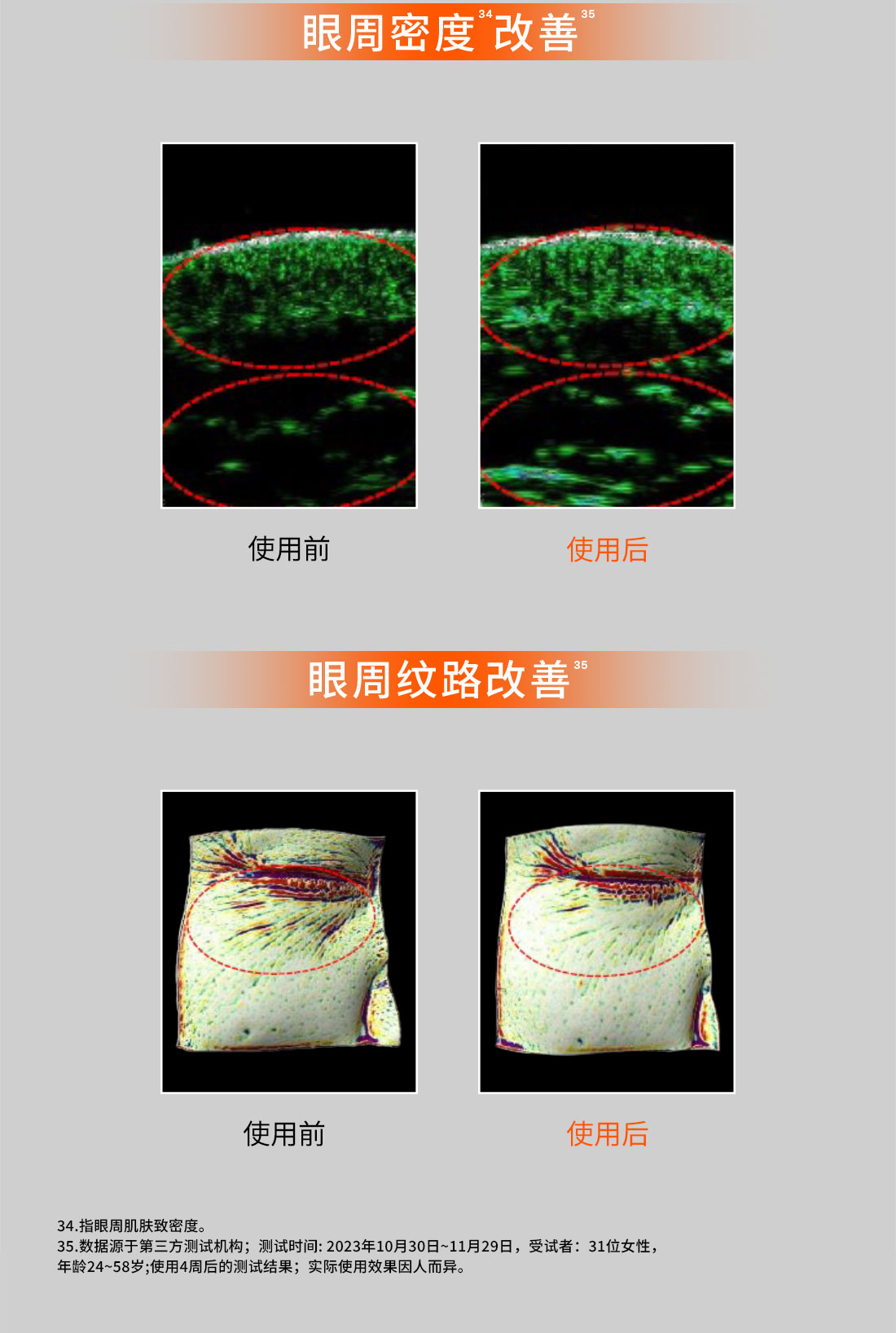 AG旗舰厅人参眼霜